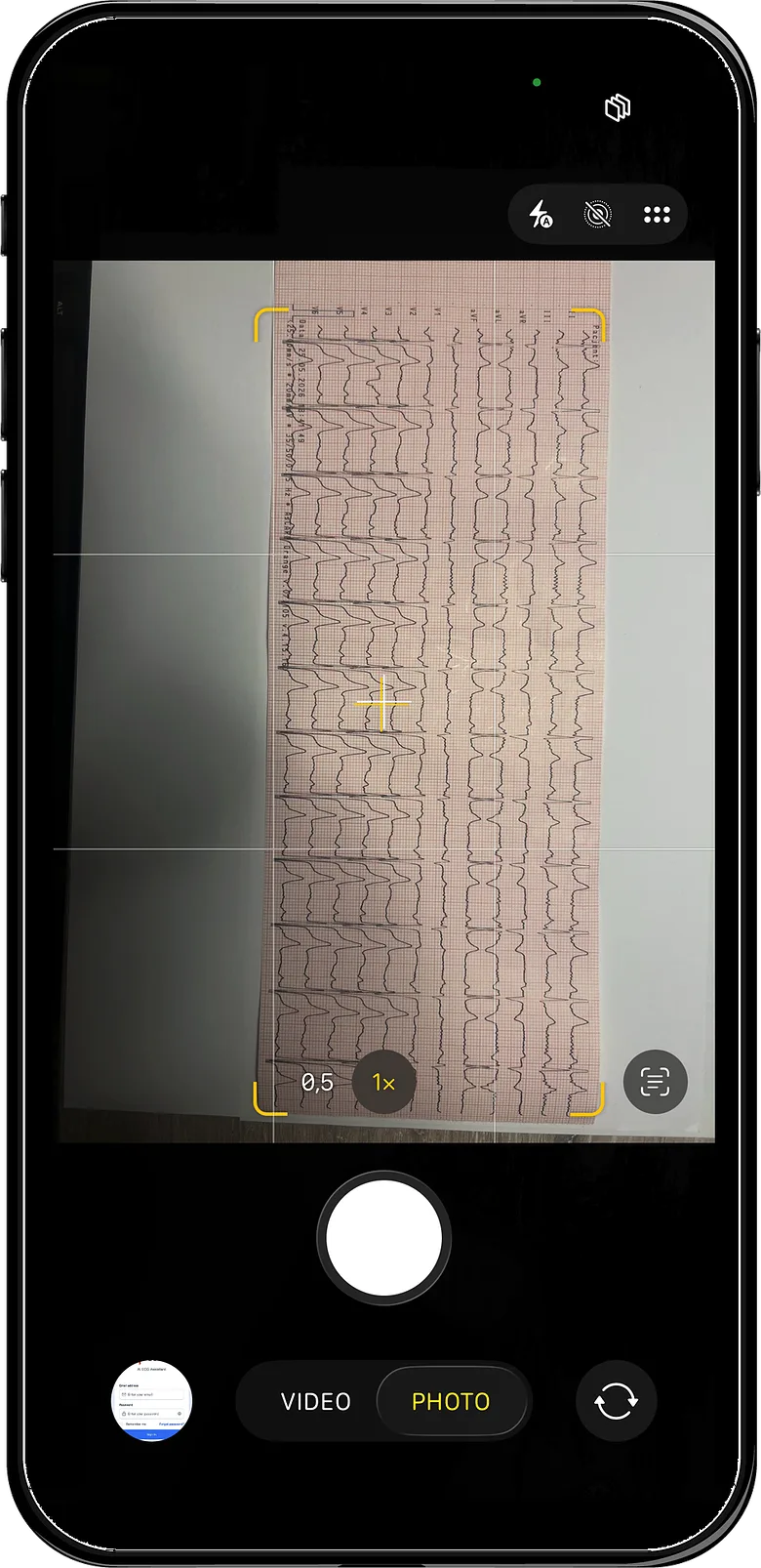 Photographing a printed 12-lead ECG with a phone camera