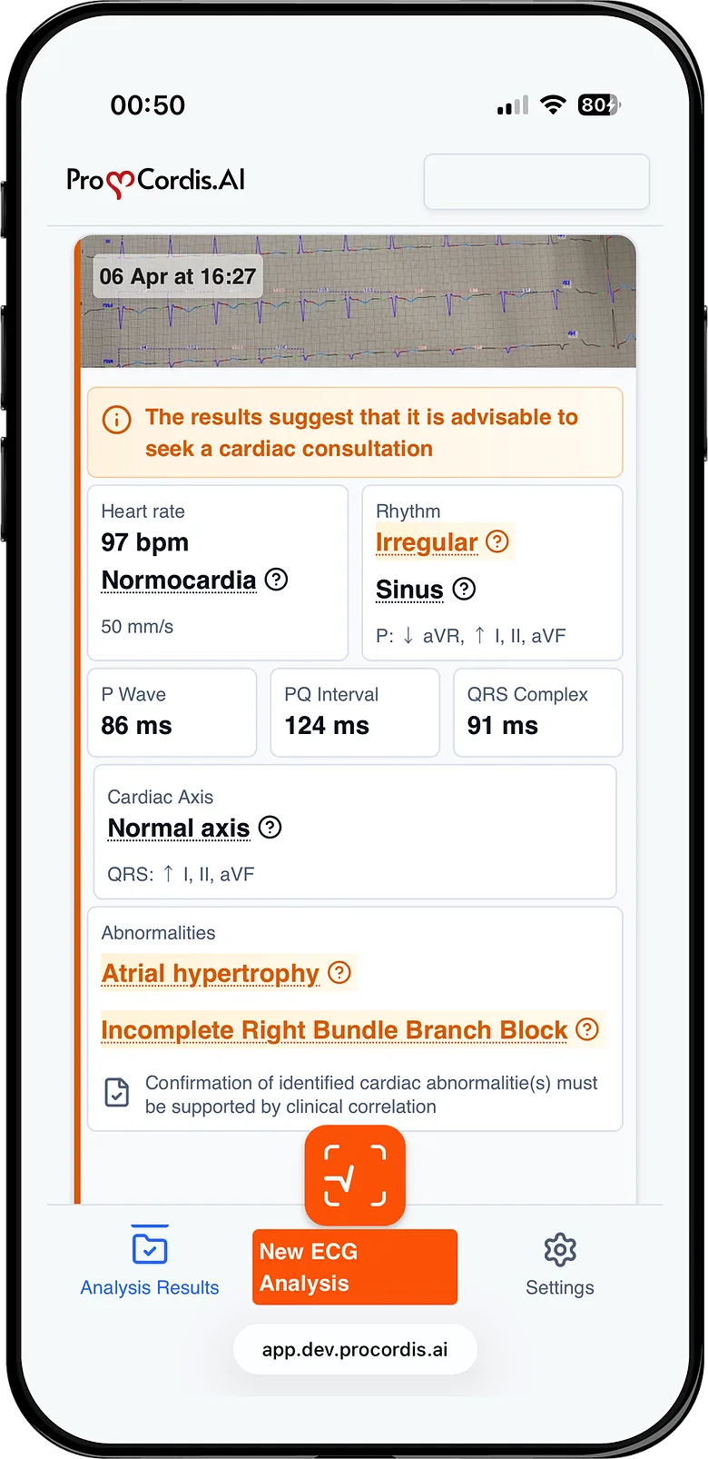 ProCordis.AI read-out: heart rate, rhythm, intervals, axis and abnormalities